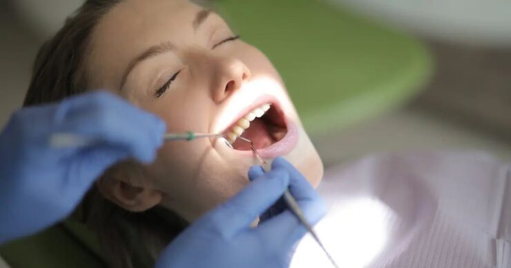 full dental cleaning